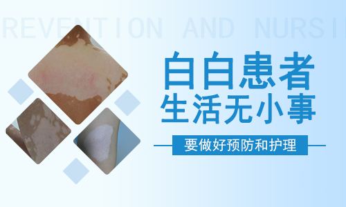 白癜風(fēng)的正確護(hù)理方法有什么